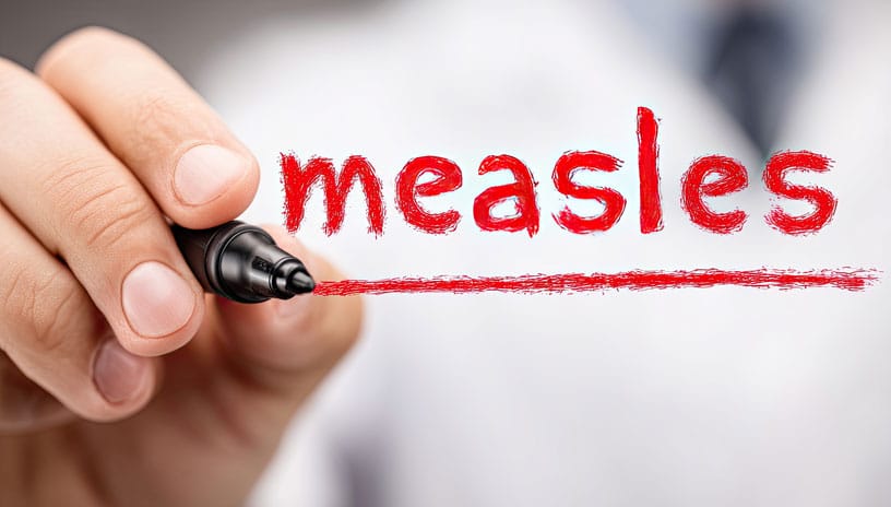 Measles Measles Outbreak Reported in Douglas County
