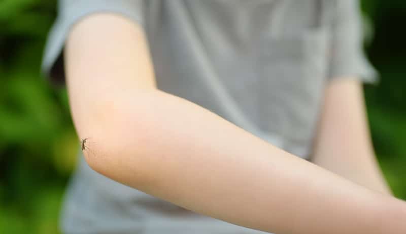 Mosquito sitting on boys arm